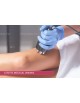 10 Séances: Massage manuel+Vibromasseur+Electrostimulation+Ultrasons+Radiofréquence+Drainage Lymphatique+Renforcemen musculaire